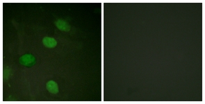 c-Jun (Phospho-Thr231) antibody