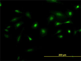 NEK2 Antibody (monoclonal) (M02)