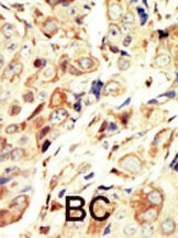IGF1 Receptor Antibody