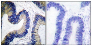 4E-BP1 (Phospho-Ser64) antibody