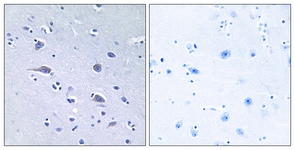 p70 S6 Kinase (Phospho-Thr229) antibody