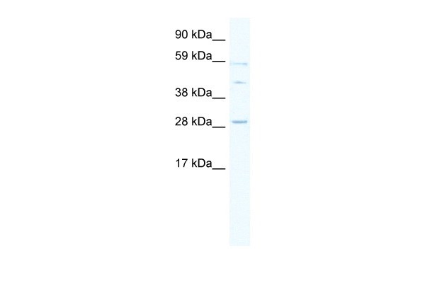 SPI1 antibody - middle region