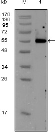 Calreticulin Antibody