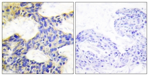S6K antibody