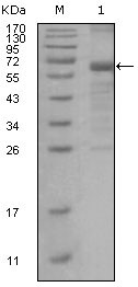 MSH6 Antibody