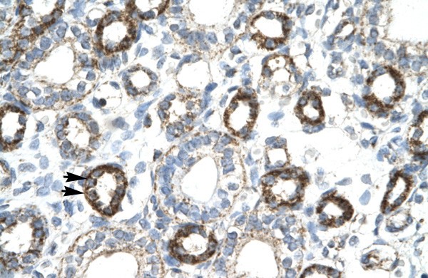 FOXF2 antibody - N-terminal region