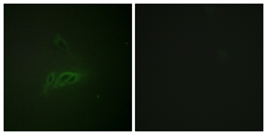 CD45 (Phospho-Ser1007) antibody