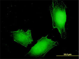 MAGEA4 Antibody (monoclonal) (M01)