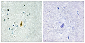 p53 (Phospho-Thr81) antibody