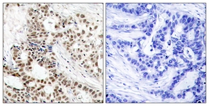 BRCA1 (Phospho-Ser1423) antibody