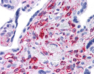 STAT5B antibody - middle region