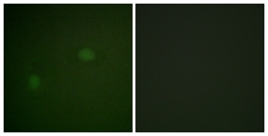 NPM antibody