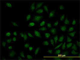 NR1H4 Antibody (monoclonal) (M02)