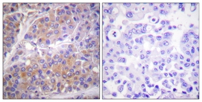 p70 S6 Kinase (Phospho-Ser371) antibody
