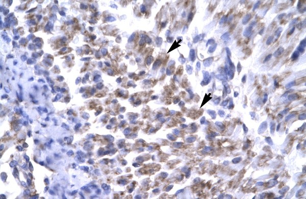 ERCC8 antibody
