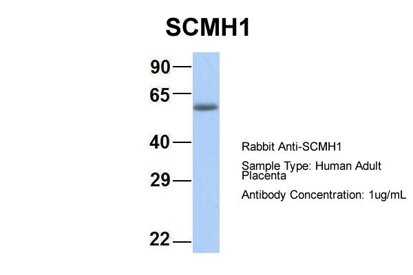 SCMH1 antibody - middle region