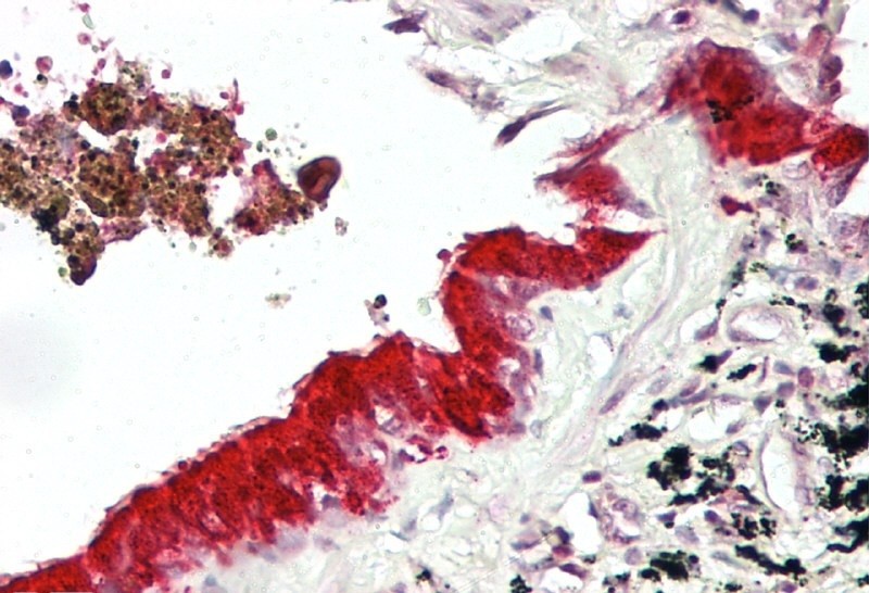 MXI1 antibody