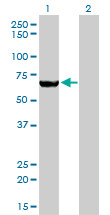 MTMR2 Antibody (monoclonal) (M03)