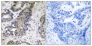 4E-BP1 antibody