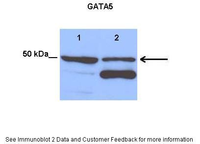 GATA5 antibody - middle region
