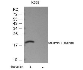 Stathmin 1 (phospho Ser38) Antibody