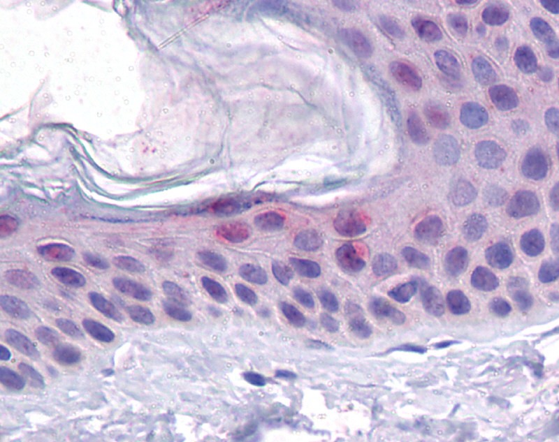 TP53 antibody
