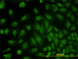 MVP Antibody (monoclonal) (M01)