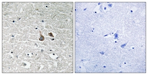 IRAK1 (Phospho-Ser376) antibody