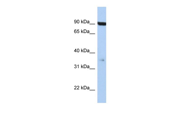 FAS antibody