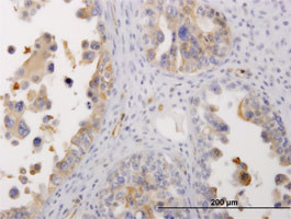 MYH9 Antibody (monoclonal) (M06)