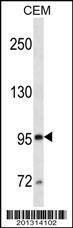 MME/CD10 Antibody