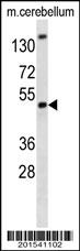 Mouse Bmi1 Antibody
