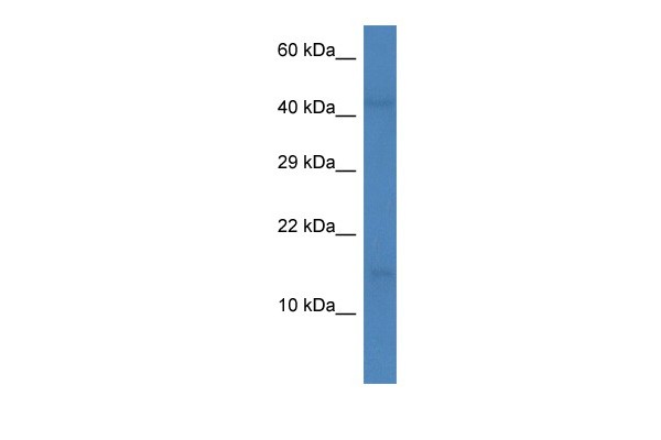 CCL16 antibody