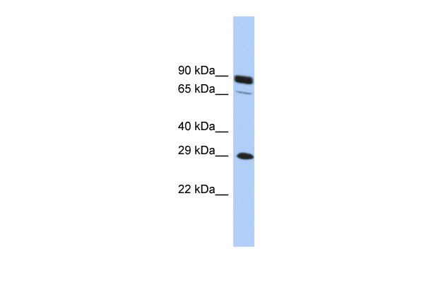 HOXC5 antibody - middle region