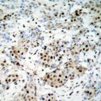 CREB (phospho Ser133) Antibody