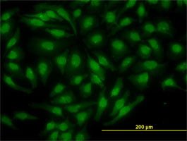 NR4A2 Antibody (monoclonal) (M07)