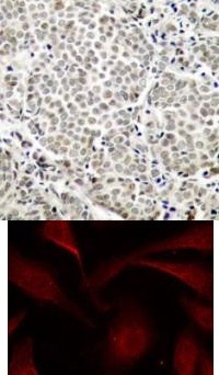 NFkB p65 (phospho Ser529) Antibody