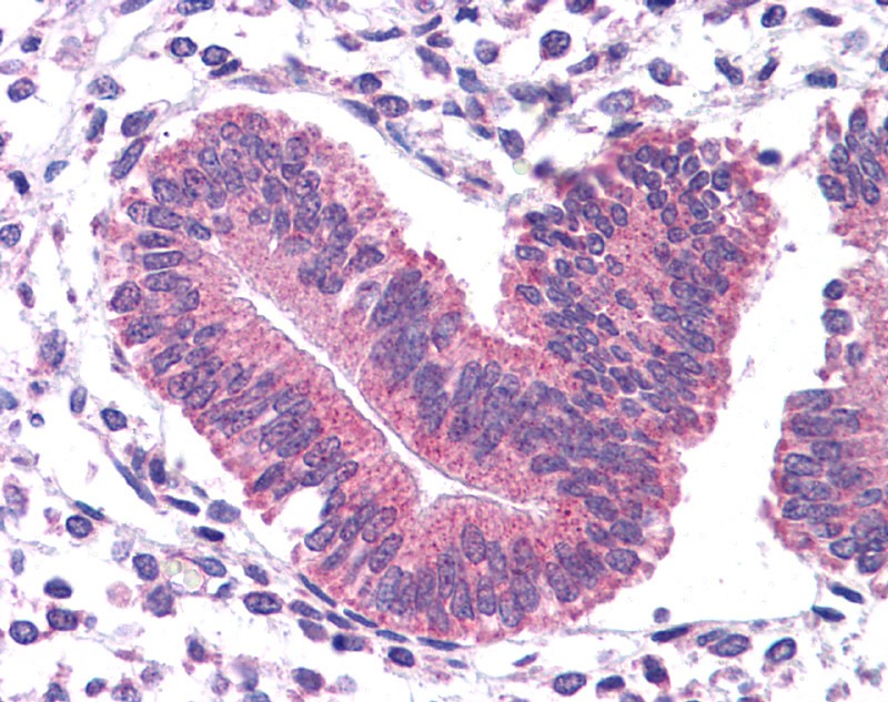 STAT3 antibody - N-terminal region