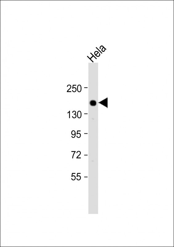 BRCA1 Antibody