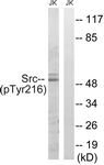 Src (Phospho-Tyr216) antibody