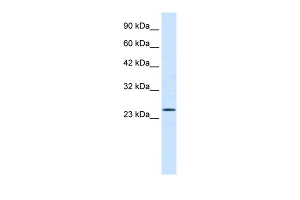 NOTCH3) Antibody