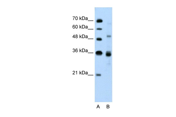 TNRC4 antibody