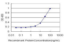 MSLN Antibody (monoclonal) (M02)