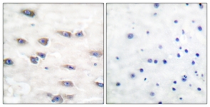 Trk A (Phospho-Tyr791) antibody