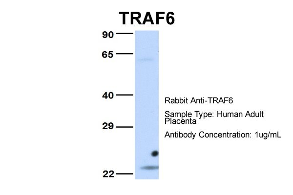 TRAF6 antibody