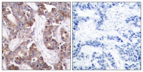 Stathmin 1 (Phospho-Ser24) antibody