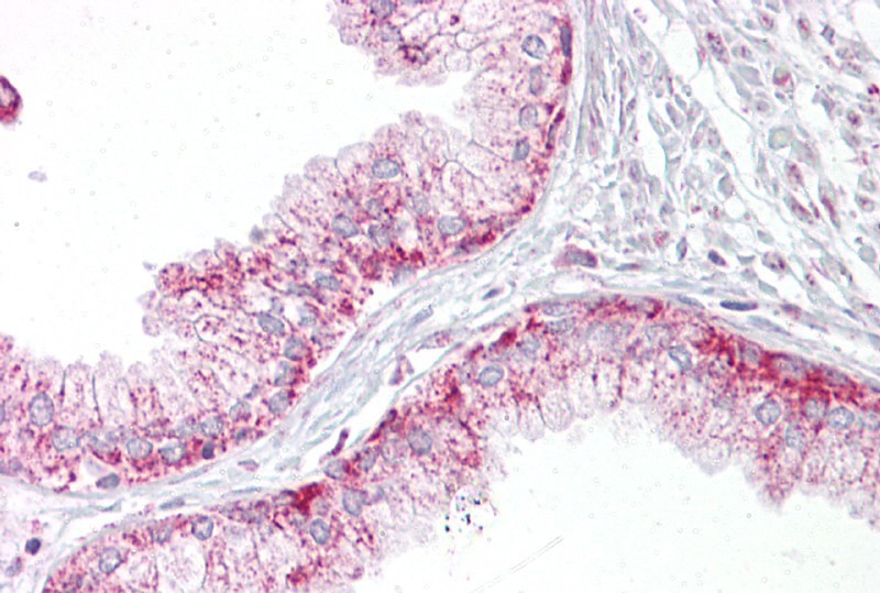 AURKA antibody