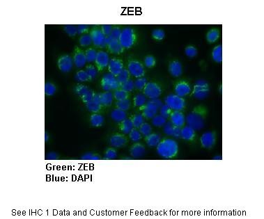 ZEB1 antibody