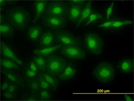 NR4A2 Antibody (monoclonal) (M08)