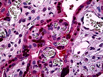 STAT5B Antibody